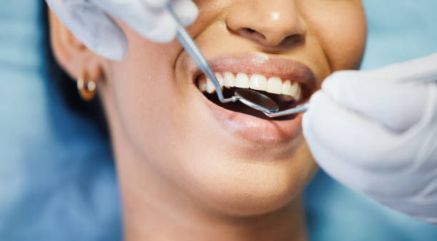 Best Emergency Treatment for Toothache in Oakville, CT