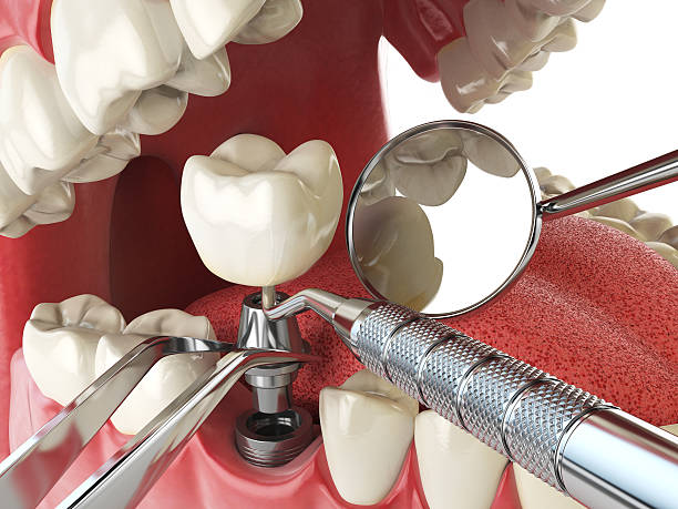 Best Emergency Dental Surgery in Oakville, CT