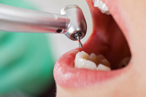 Best Walk-In Emergency Dentist in Oakville, CT
